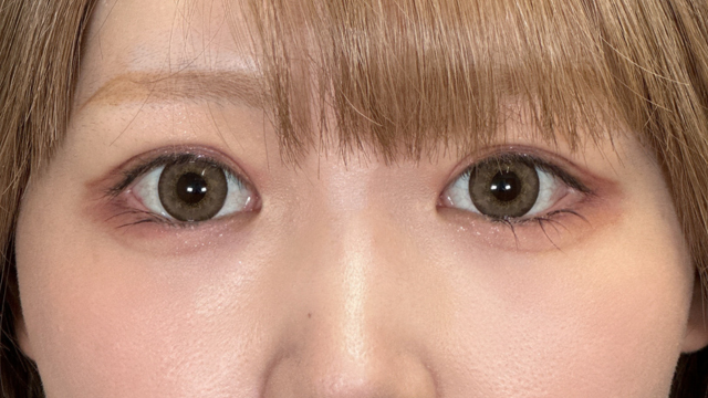 Postoperative Condition Part 1