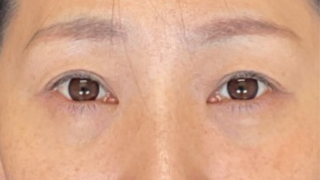 Postoperative Condition Part 1