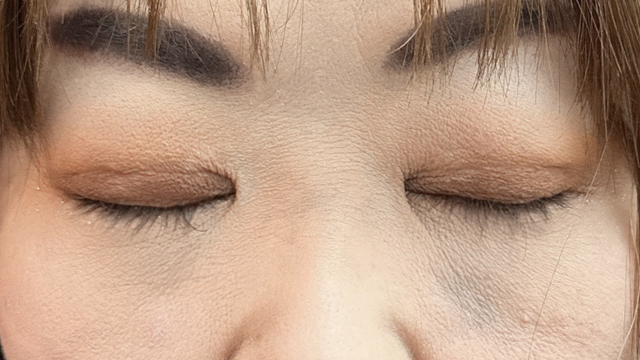 Postoperative Condition Part 1