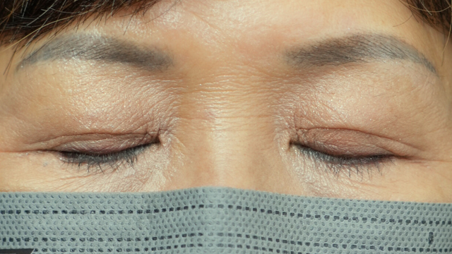 Postoperative Condition Part 1