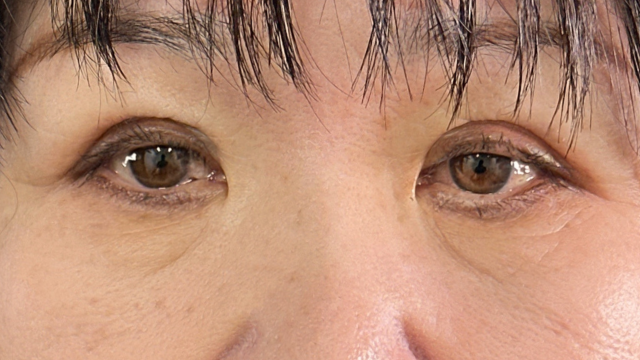 Postoperative Condition Part 1