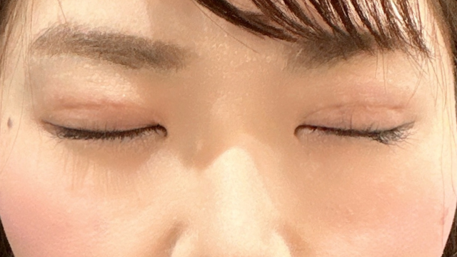 Postoperative Condition Part 1