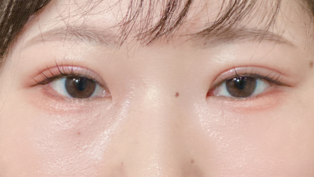 Postoperative Condition Part 1