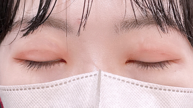 Postoperative Condition Part 1