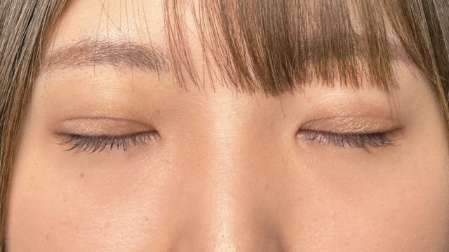 Postoperative Condition Part 1