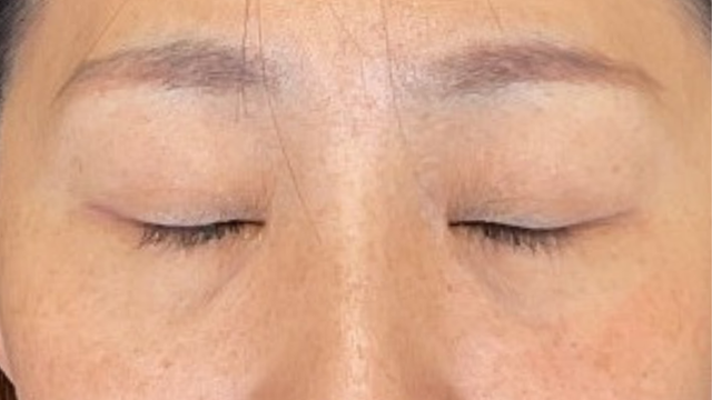 Postoperative Condition Part 1