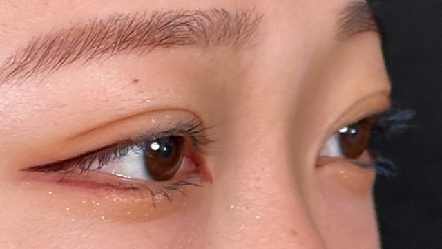 Postoperative Condition Part 1