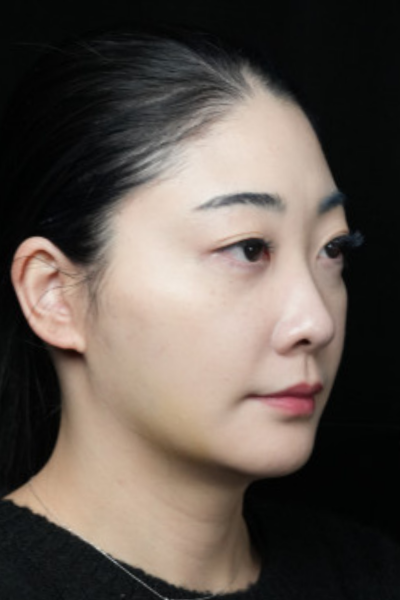 Postoperative Condition Part 1