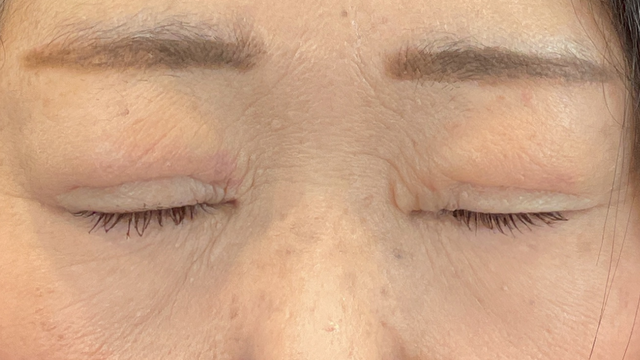 Postoperative Condition Part 1