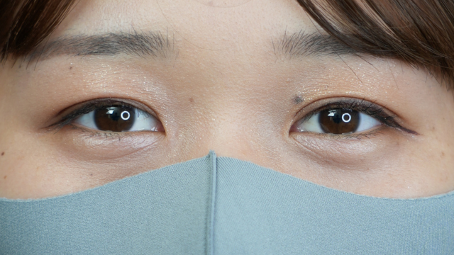 Postoperative Condition Part 1