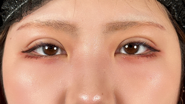 Postoperative Condition Part 1