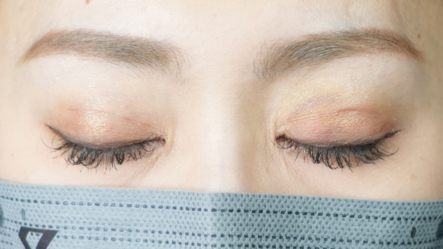 Postoperative Condition Part 1