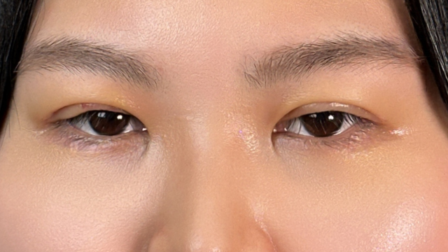 Postoperative Condition Part 1