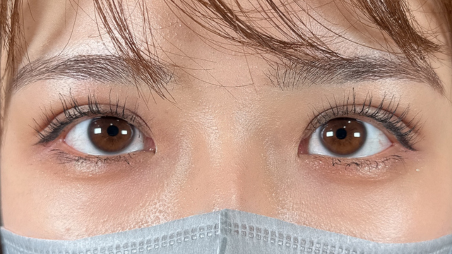 Postoperative Condition Part 1