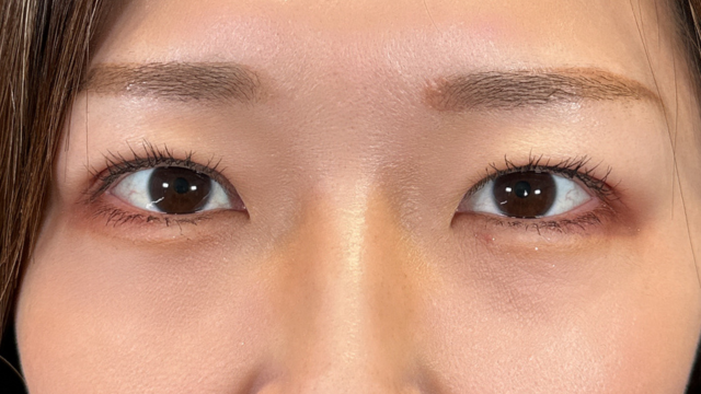 Postoperative Condition Part 1