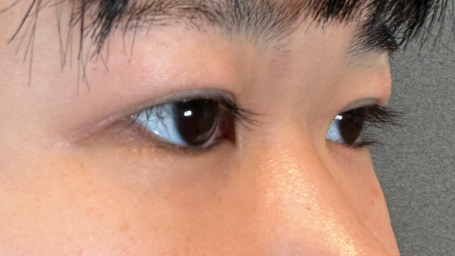 Postoperative Condition Part 1