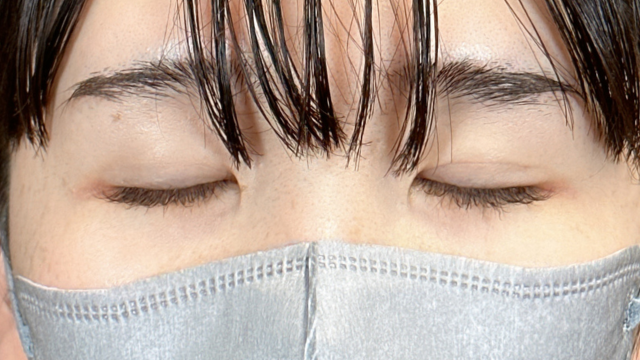 Postoperative Condition Part 1