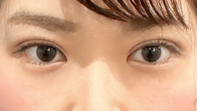 Postoperative Condition Part 1