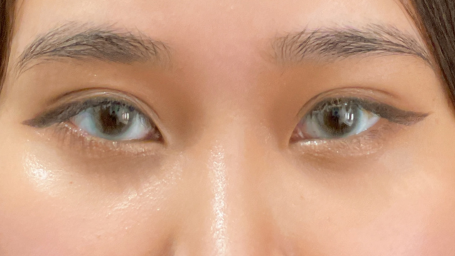 Postoperative Condition Part 1