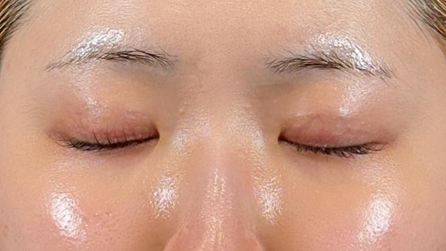 Postoperative Condition Part 1