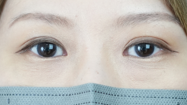 Postoperative Condition Part 1