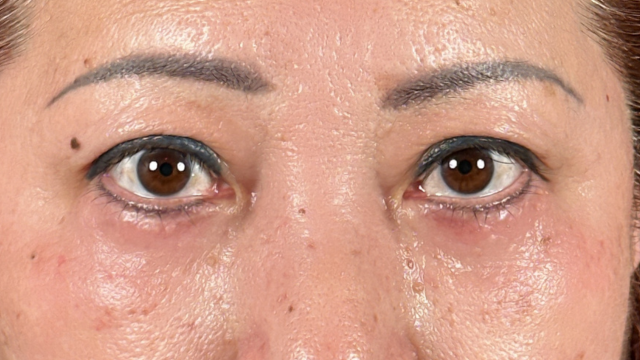 Postoperative Condition Part 1