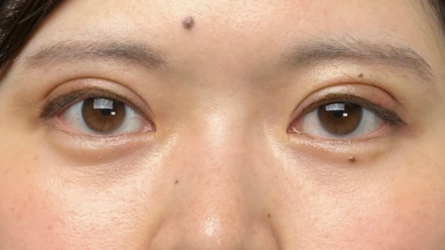 Postoperative Condition Part 1