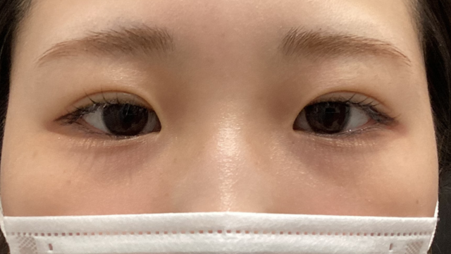 Postoperative Condition Part 1