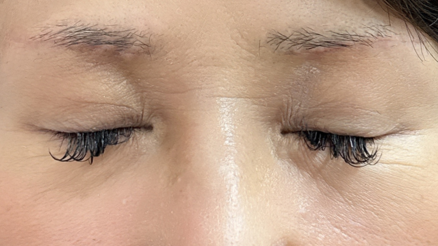 Postoperative Condition Part 1