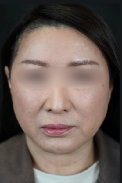 Postoperative Condition Part 1