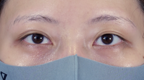 Postoperative Condition Part 1