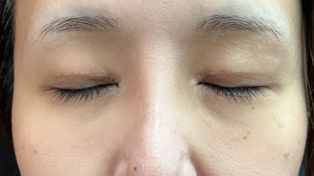 Postoperative Condition Part 1