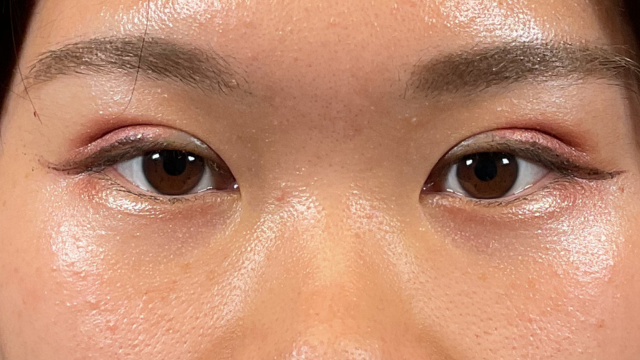 Postoperative Condition Part 1