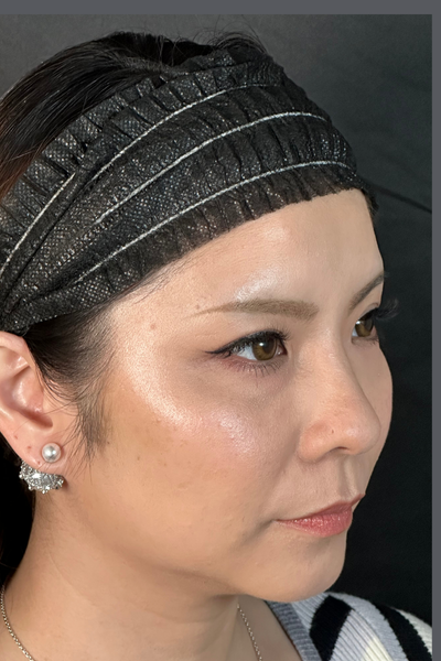 手術前の状態 その1