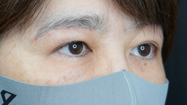 Postoperative Condition Part 1