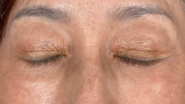 Postoperative Condition Part 1