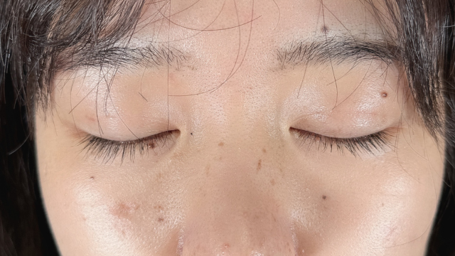 Postoperative Condition Part 1