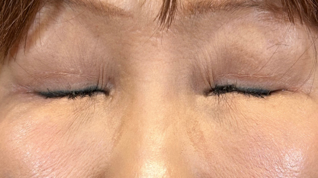 Postoperative Condition Part 1