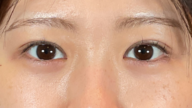 Postoperative Condition Part 1