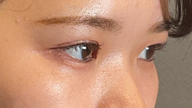 Postoperative Condition Part 1