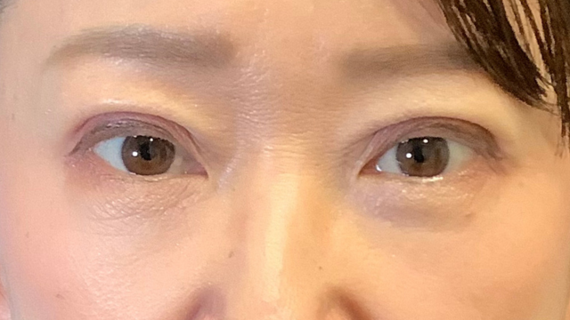 Postoperative Condition Part 1