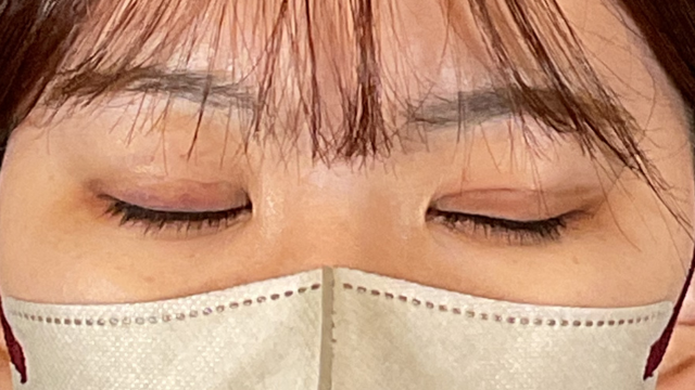 Postoperative Condition Part 1