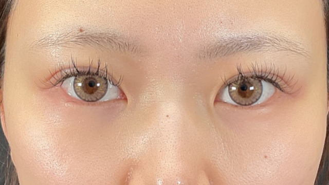 Postoperative Condition Part 1