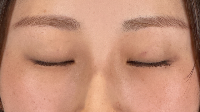 Postoperative Condition Part 1