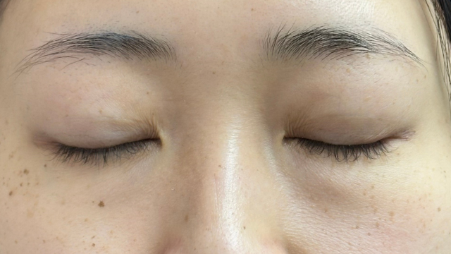 Postoperative Condition Part 1