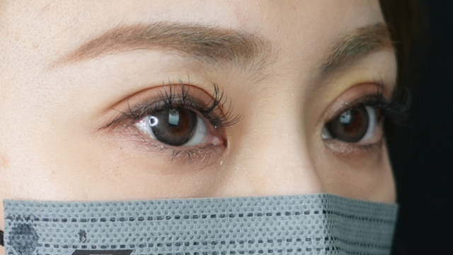 Postoperative Condition Part 1