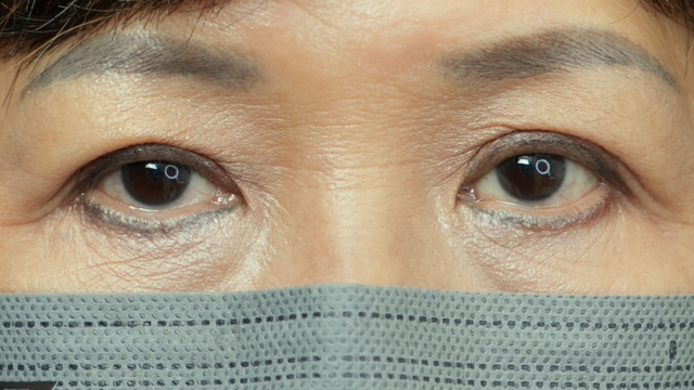 Postoperative Condition Part 1