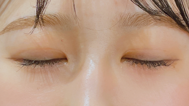 Postoperative Condition Part 1