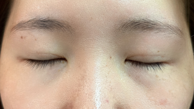 Postoperative Condition Part 1