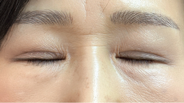 Postoperative Condition Part 1